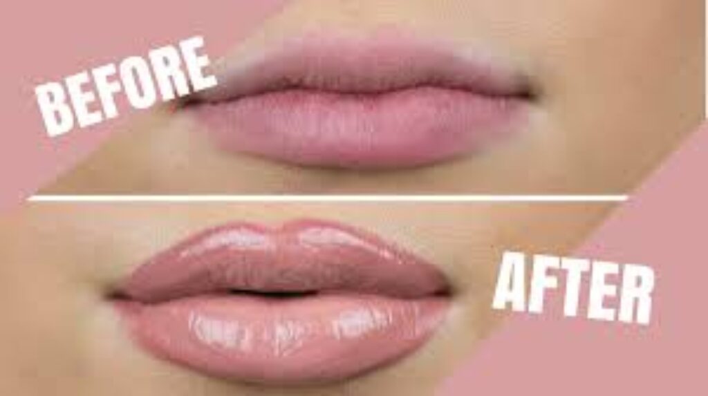 how to get beautiful lips