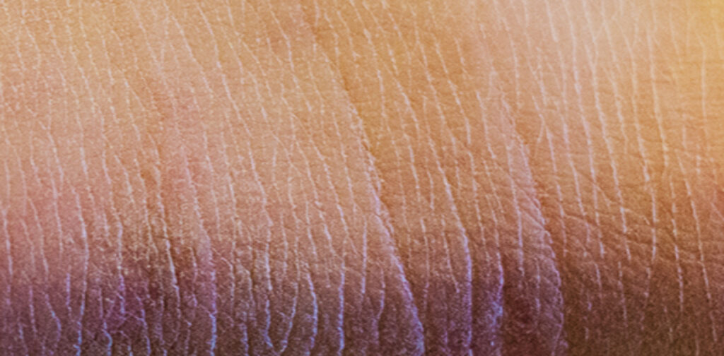 what causes dry skin on legs